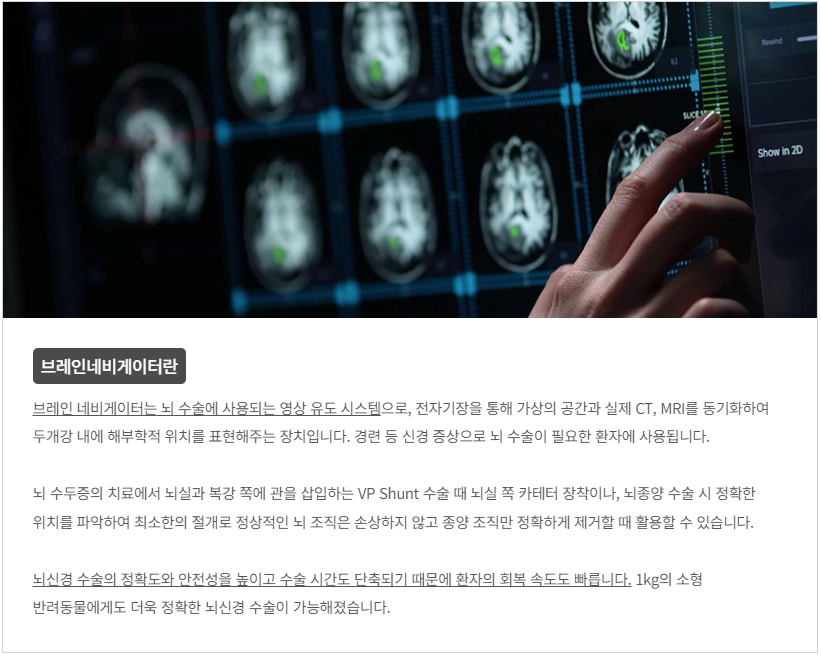 브레인네비게이터