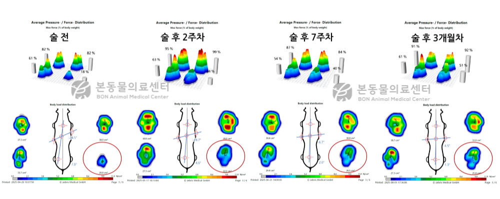 강아지 TPLO와 반월판 제거 수술 후 보행 검사 결과. 이상이 있었던 오른쪽 뒷다리에 체중을 실을 수 있게 되었다