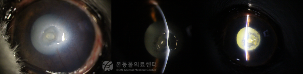 강아지 각막궤양 환자의 슬릿 현미경 검사 결과. 매우 깊은 각막 궤양으로 각막이 심하게 얇아져 있는 상태